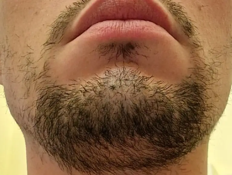 Diradamento barba