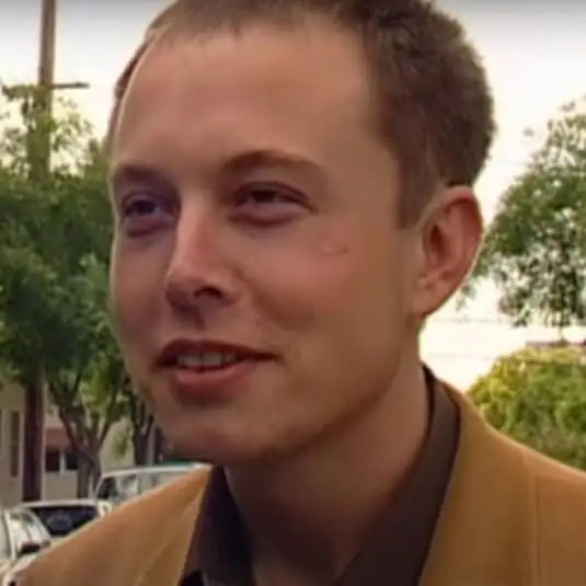 Elon Musk prima del trapianto di capelli 5