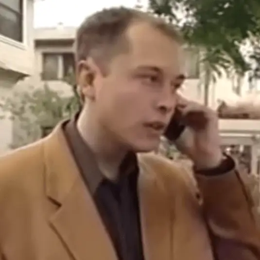 Elon Musk prima del trapianto di capelli 2