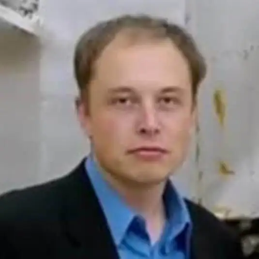 Elon Musk prima del trapianto di capelli
