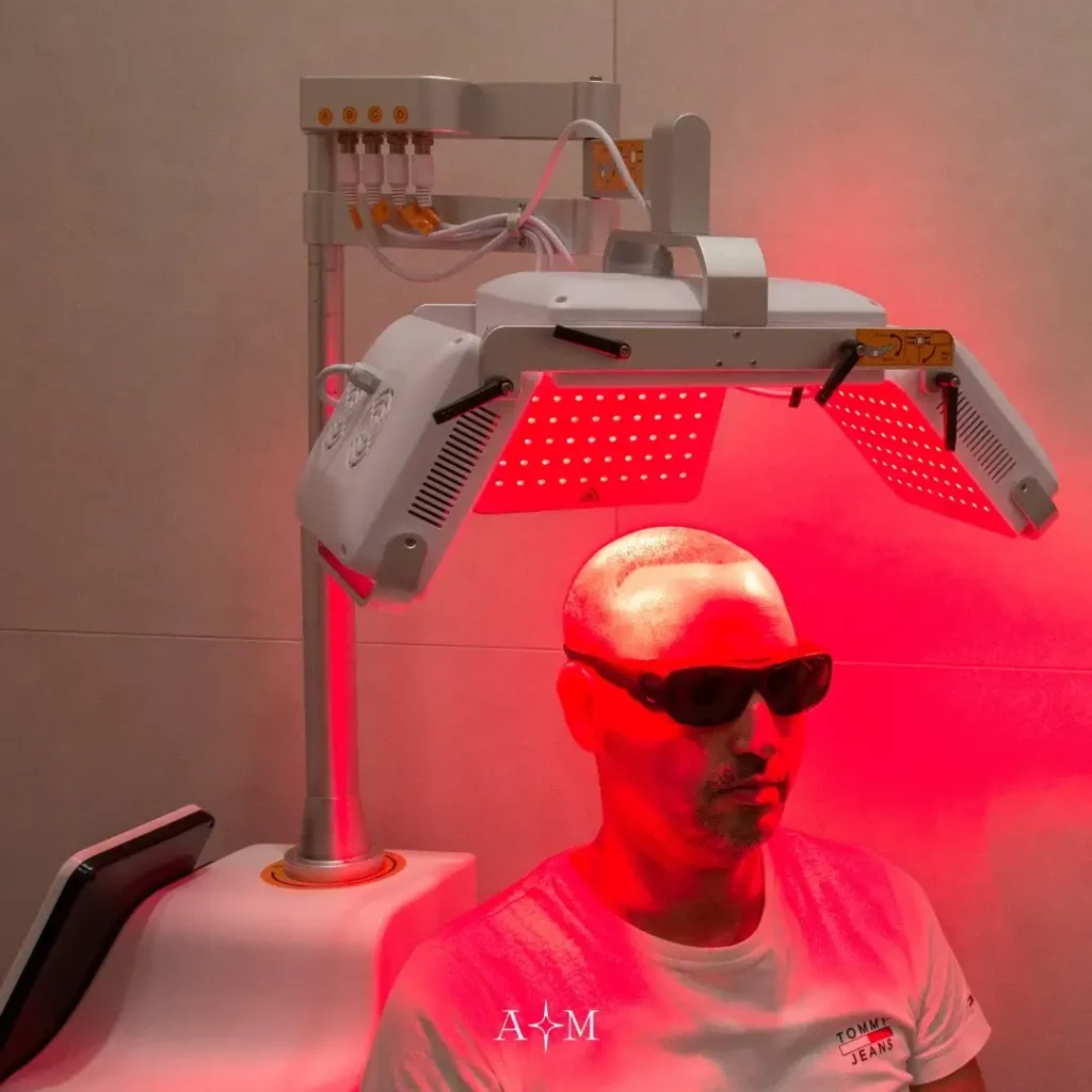 laserterapia per capelli