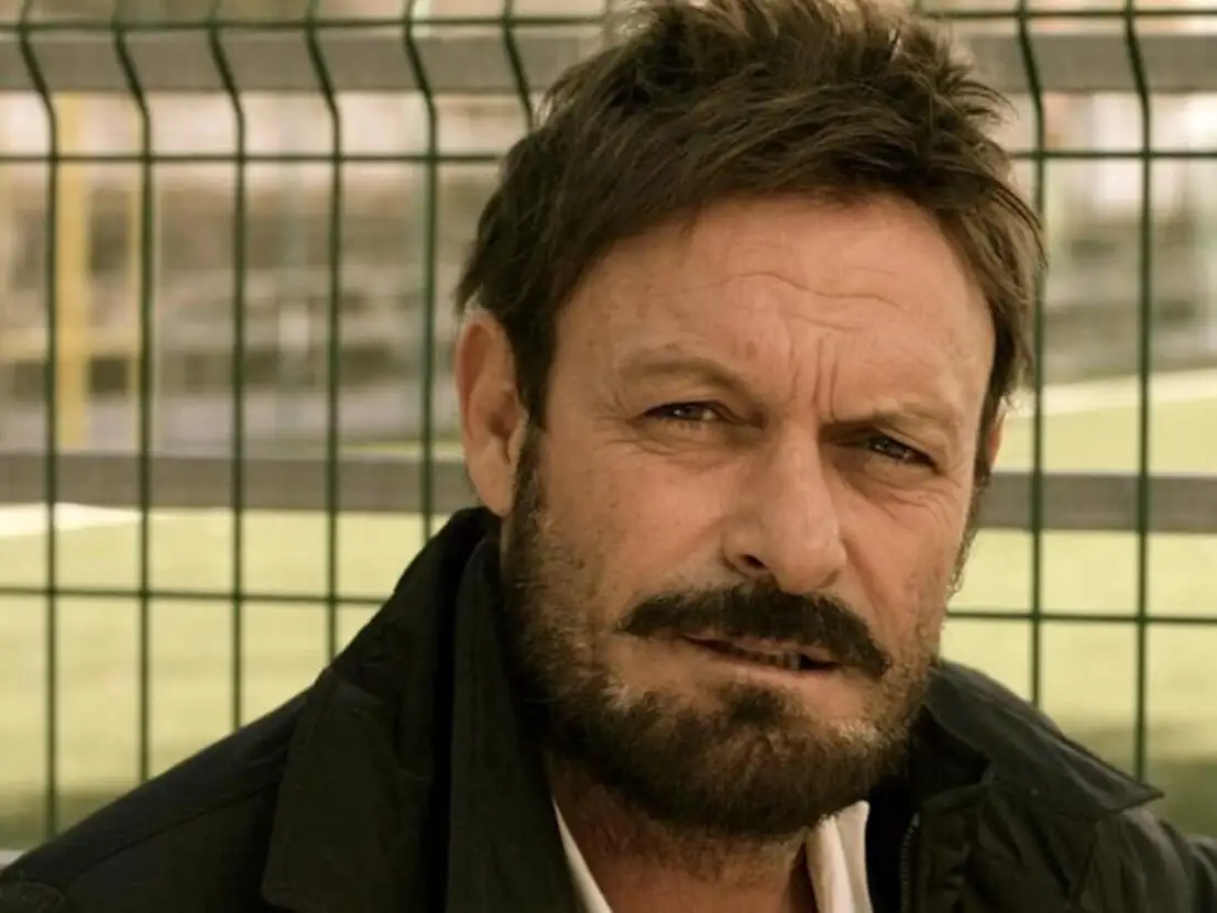 Schillaci trapianto capelli