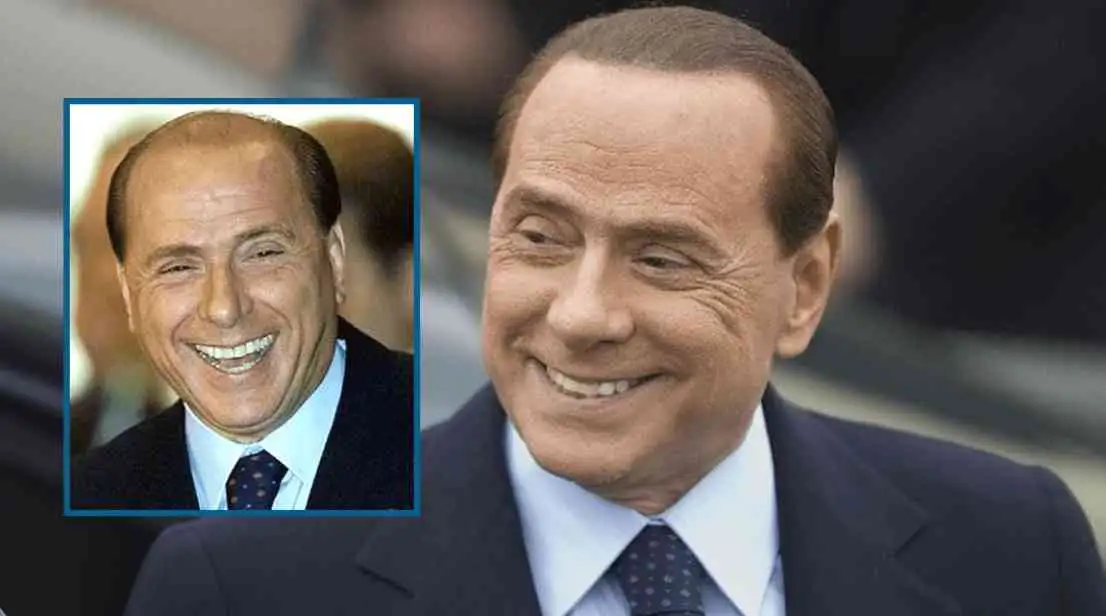 Silvio Berlusconi trapianto capelli