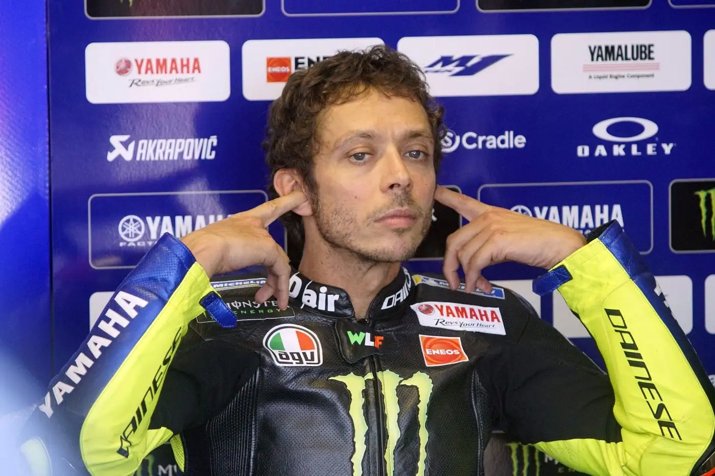 trapianto capelli Valentino Rossi